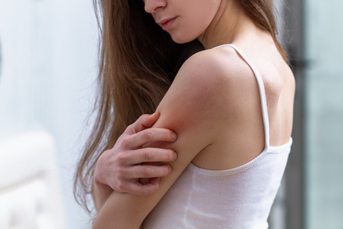 Female scratching her arm displaying signs and symptoms of Eczema